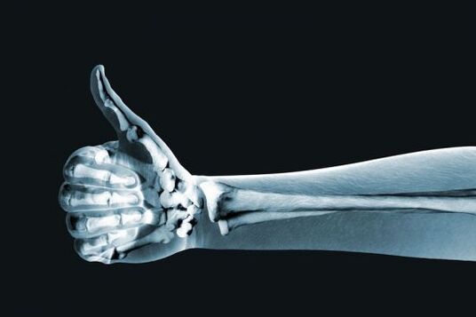 Radiographie pour diagnostiquer la douleur dans les articulations des doigts