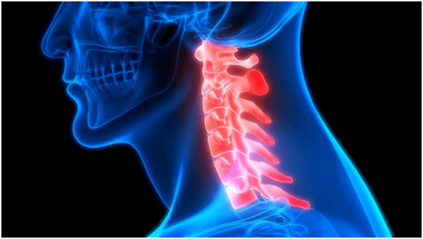 la douleur au cou entraîne des maux de dos