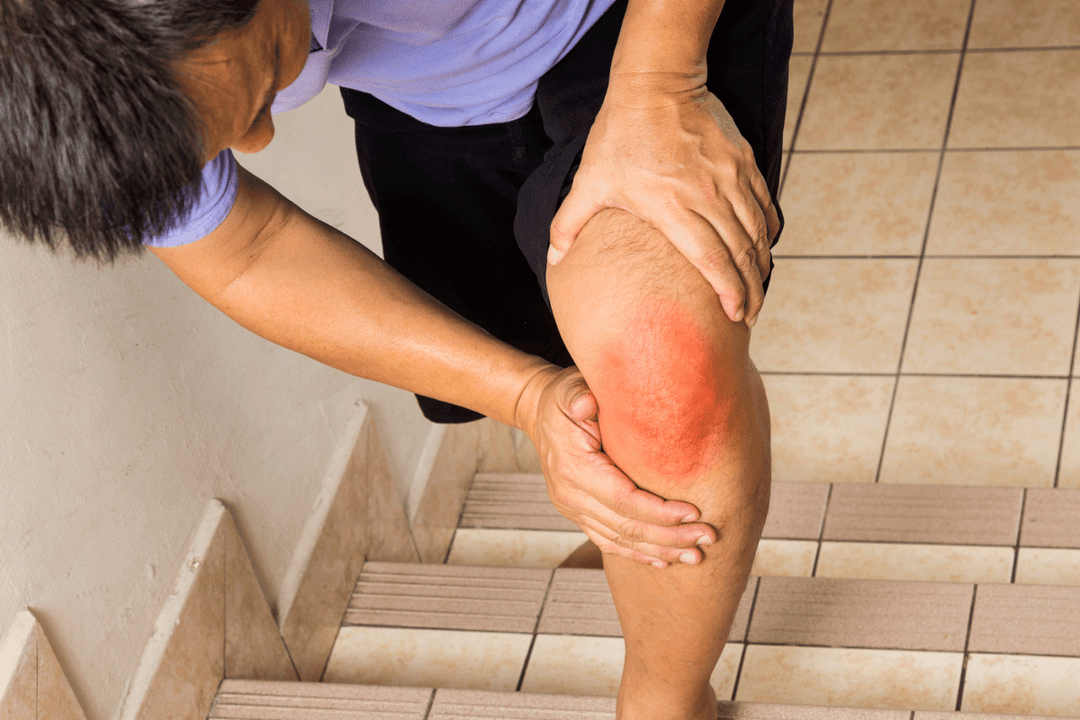 douleurs articulaires dues à l'arthrose