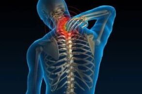 L'ostéochondose cervicale entraîne des douleurs dans le cou